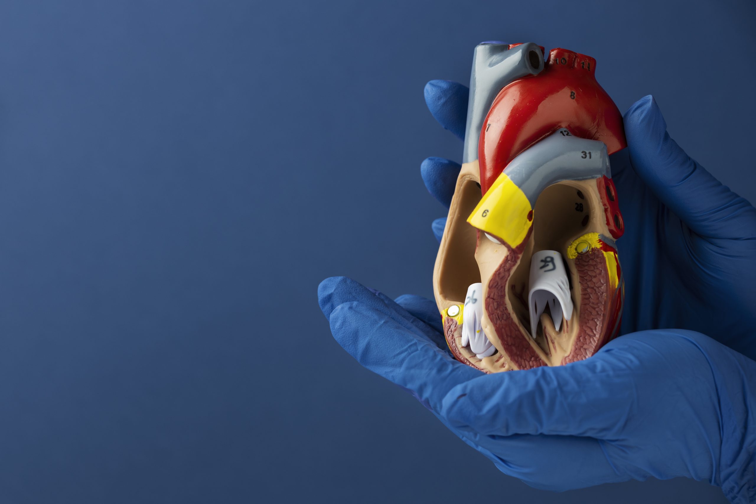 What is Cost of Heart Bypass Surgery