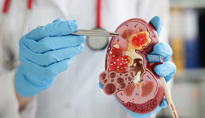 नेफ्रोलॉजी म्हणजे काय ? (What is Nephrology?)