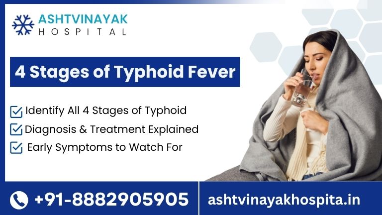 4 stage of typhoid