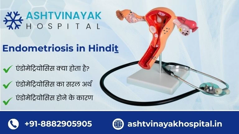 Endometriosis in Hindi