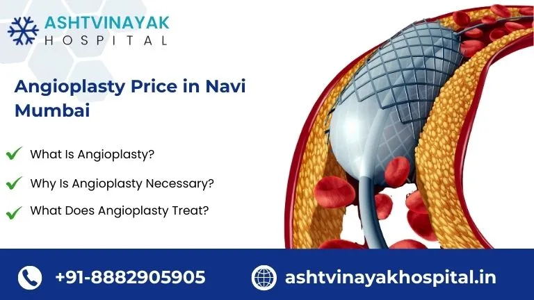 angioplasty price