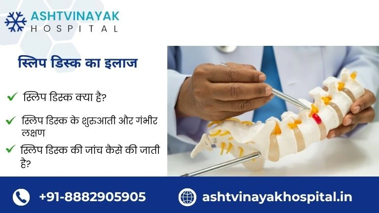 स्लिप डिस्क का इलाज